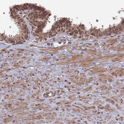 Immunohistochemistry-Paraffin: CNTD2 Antibody [NBP2-13850]