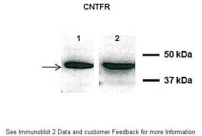 Western Blot: CNTFR Antibody [NBP1-68943]