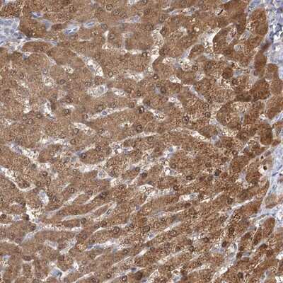 Immunohistochemistry-Paraffin: CNTLN Antibody [NBP1-88795]
