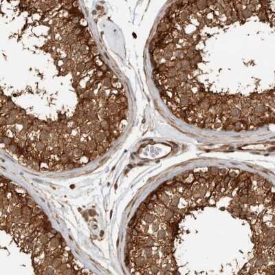 Immunohistochemistry-Paraffin: CNTROB Antibody [NBP1-82835]