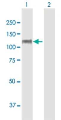 Western Blot: CNTROB Antibody [H00116840-B01P]