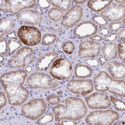 Immunohistochemistry-Paraffin: COA5 Antibody [NBP2-31690]