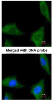 Immunocytochemistry/ Immunofluorescence: COASY Antibody [NBP1-32649]