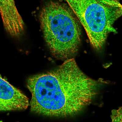 Immunocytochemistry/ Immunofluorescence: COASY Antibody [NBP1-84991]