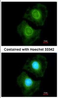 Immunocytochemistry/ Immunofluorescence: COASY Antibody [NBP2-15934]