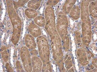 Immunohistochemistry-Paraffin: COASY Antibody [NBP1-32649]