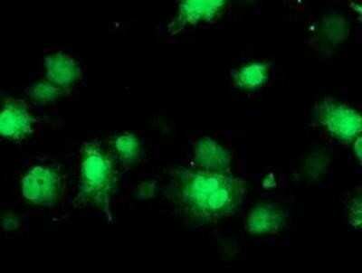 Immunocytochemistry/ Immunofluorescence: COASY Antibody (OTI3B3) - Azide and BSA Free [NBP2-72224]