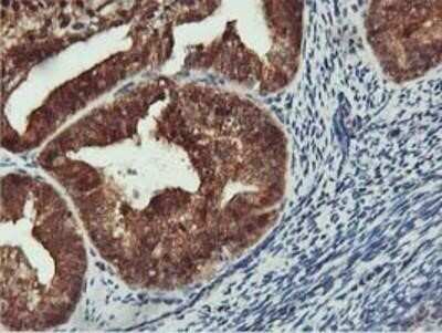Immunohistochemistry: COASY Antibody (OTI3B3) - Azide and BSA Free [NBP2-72224]