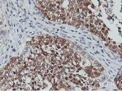 Immunohistochemistry: COASY Antibody (OTI3B3) - Azide and BSA Free [NBP2-72224]