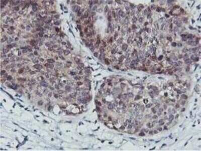 Immunohistochemistry: COASY Antibody (OTI3B3) - Azide and BSA Free [NBP2-72224]