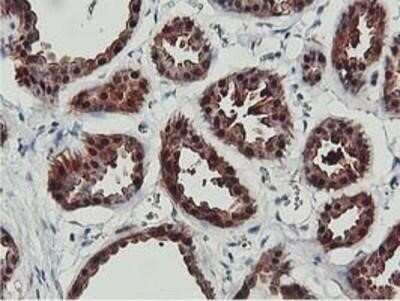 Immunohistochemistry: COASY Antibody (OTI3B3) - Azide and BSA Free [NBP2-72224]