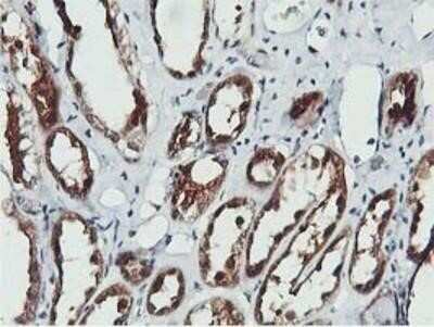 Immunohistochemistry: COASY Antibody (OTI3B3) - Azide and BSA Free [NBP2-72224]