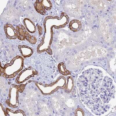 Immunohistochemistry-Paraffin: COBLL1 Antibody [NBP2-32033]