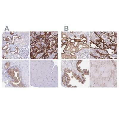 Immunohistochemistry-Paraffin: COBLL1 Antibody [NBP2-32033]