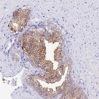 Immunohistochemistry-Paraffin: COBLL1 Antibody [NBP2-32033]