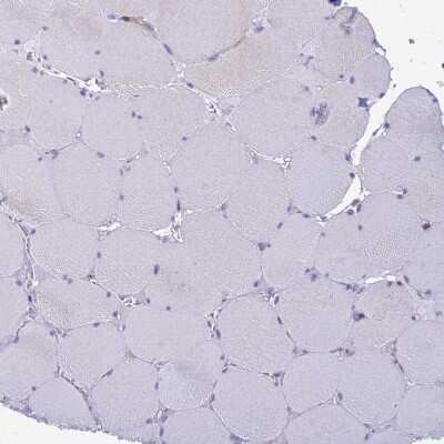 Immunohistochemistry-Paraffin: COBLL1 Antibody [NBP2-32033]