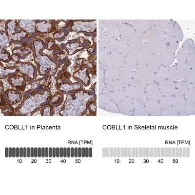 Immunohistochemistry-Paraffin: COBLL1 Antibody [NBP2-32033]