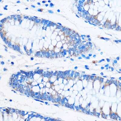Immunohistochemistry-Paraffin: COG1 Antibody - Azide and BSA Free [NBP3-15543]