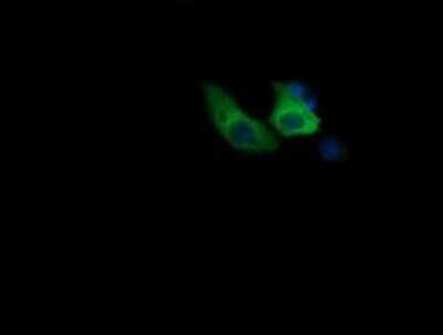 Immunocytochemistry/ Immunofluorescence: COG6 Antibody (OTI1B8) - Azide and BSA Free [NBP2-72088]