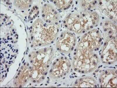 Immunohistochemistry: COG6 Antibody (OTI1B8) - Azide and BSA Free [NBP2-72088]