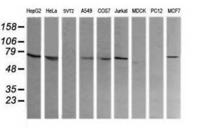 Western Blot: COG6 Antibody (OTI1B8)Azide and BSA Free [NBP2-72088]