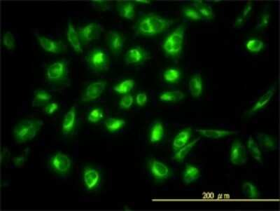 Immunocytochemistry/ Immunofluorescence: COG7 Antibody (3G4-1B3) [H00091949-M01]