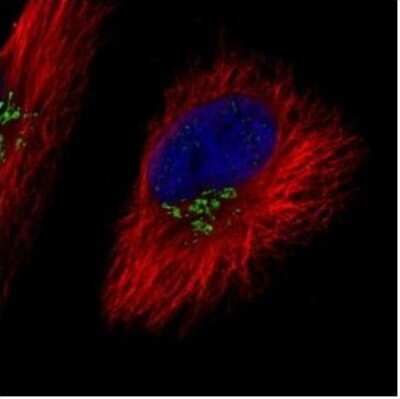 Immunocytochemistry/ Immunofluorescence: COG7 Antibody [NBP2-14914]