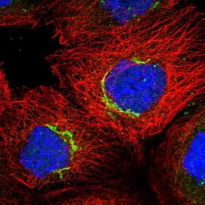 Immunocytochemistry/ Immunofluorescence: COG7 Antibody [NBP2-47502]