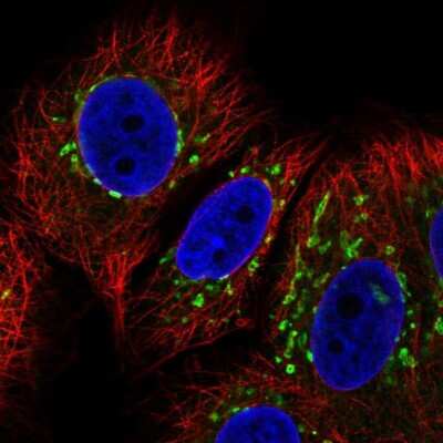 Immunocytochemistry/ Immunofluorescence: COG7 Antibody [NBP2-56614]