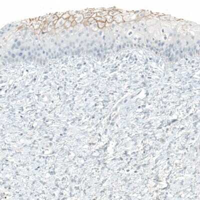 Immunohistochemistry-Paraffin: COL14A1 Antibody [NBP1-86877]