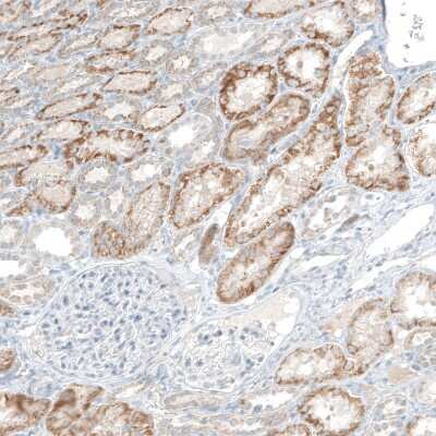 Immunohistochemistry-Paraffin: COL14A1 Antibody [NBP1-86877]