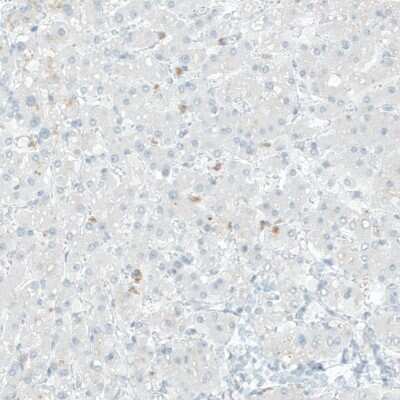 Immunohistochemistry-Paraffin: COL14A1 Antibody [NBP1-86877]