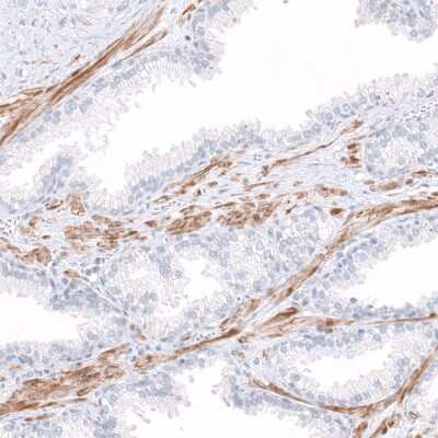 Immunohistochemistry-Paraffin: COL14A1 Antibody [NBP1-86877]