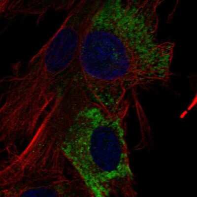 Immunocytochemistry/ Immunofluorescence: COL15A1 Antibody [NBP1-91088]