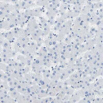 Immunohistochemistry-Paraffin: COL15A1 Antibody [NBP1-91087]