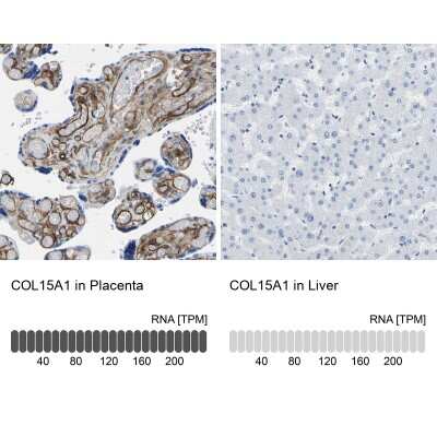 Immunohistochemistry-Paraffin: COL15A1 Antibody [NBP1-91087]
