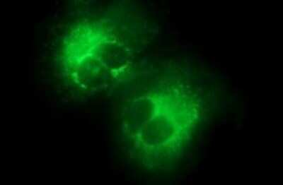 Immunocytochemistry/ Immunofluorescence: COL15A1 Antibody (OTI1C5) - Azide and BSA Free [NBP2-70422]