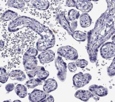 Immunohistochemistry-Paraffin: COL22A1 Antibody [NBP1-91056]