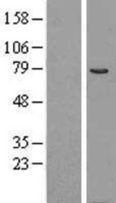 Western Blot: COL4A3BP Overexpression Lysate [NBL1-09354]