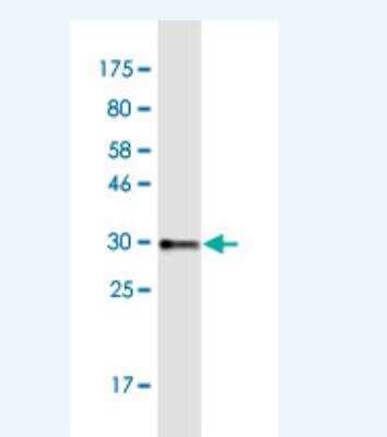 Western Blot: COL8A2 Antibody (1F4) [H00001296-M01-100ug]