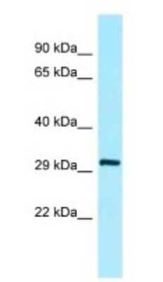 Western Blot: COLEC5 Antibody [NBP1-98277]