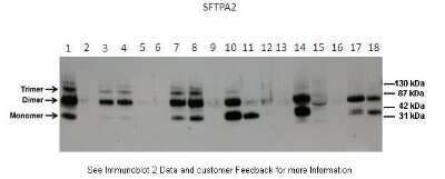 Western Blot: COLEC5 Antibody [NBP1-98277]