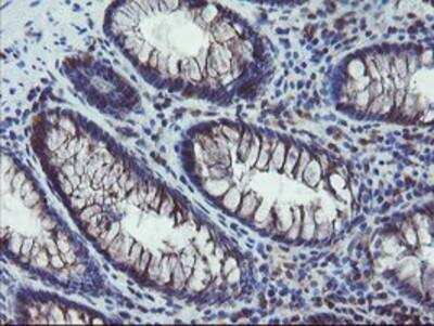 Immunohistochemistry-Paraffin: COMMD1 Antibody (OTI1F2) [NBP2-03755]