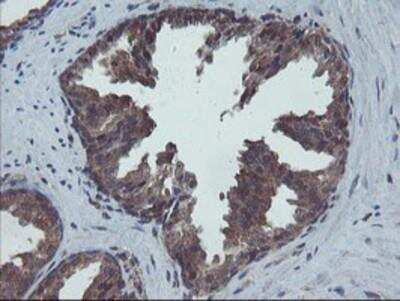Immunohistochemistry-Paraffin: COMMD1 Antibody (OTI1F2) [NBP2-03755]