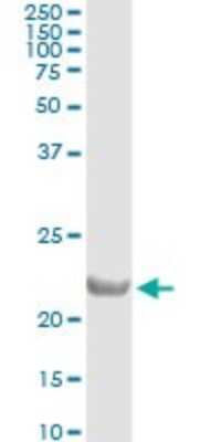 Immunoprecipitation: COMMD1 Antibody (2A12) [H00150684-M01]