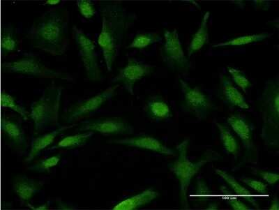 Immunocytochemistry/ Immunofluorescence: COMMD1 Antibody (2B12) [H00150684-M03]