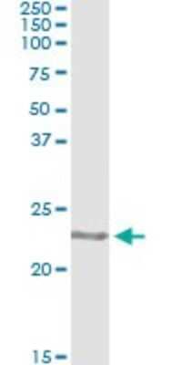 Immunoprecipitation: COMMD1 Antibody (2B12) [H00150684-M03]