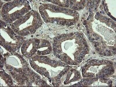 Immunohistochemistry: COMMD1 Antibody (OTI2E2) [NBP2-46331]