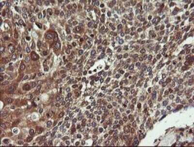Immunohistochemistry: COMMD1 Antibody (OTI2E2) [NBP2-46331]
