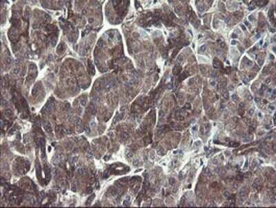 Immunohistochemistry: COMMD1 Antibody (OTI2E2) [NBP2-46331]